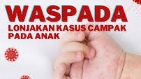 Kasus Campak di Lampura Melonjak, Pemkab Gencarkan Imunisasi Kejar